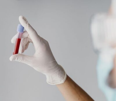 Il sangue aiuta a diagnosticare l’Alzheimer: il nuovo studio